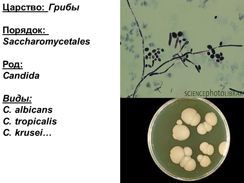 Царство: Грибы  Порядок:   Saccharomycetales  Род:  Candida  Виды: C.